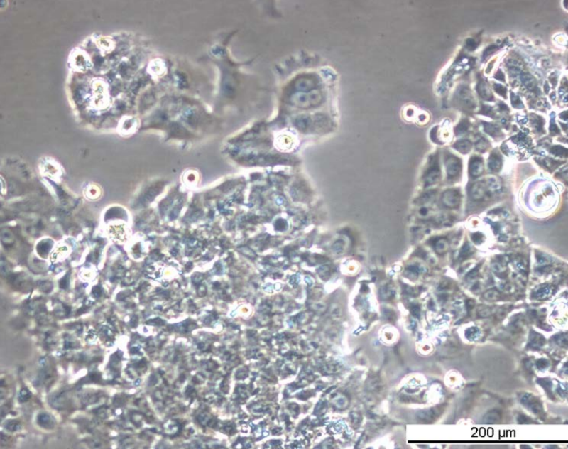 MCF7 TAMR-4 Cell Line. Late log phase. Image courtesy of the European Collection of Authenticated Cell Cultures (ECACC), UK.