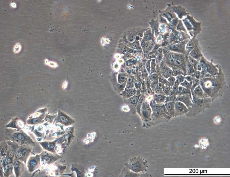 MCF7 TAMR-4 Cell Line. Mid log phase. Image courtesy of the European Collection of Authenticated Cell Cultures (ECACC), UK.