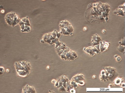MCF7/TAMR-7 Cell Line. Mid log phase. Image courtesy of the European Collection of Authenticated Cell Cultures (ECACC), UK