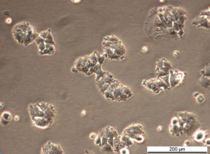 MCF7/TAMR-7 Cell Line. Mid log phase. Image courtesy of the European Collection of Authenticated Cell Cultures (ECACC)