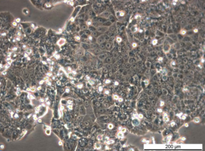 MCF7/TAMR-7 Cell Line. Late log phase. Image courtesy of the European Collection of Authenticated Cell Cultures (ECACC)