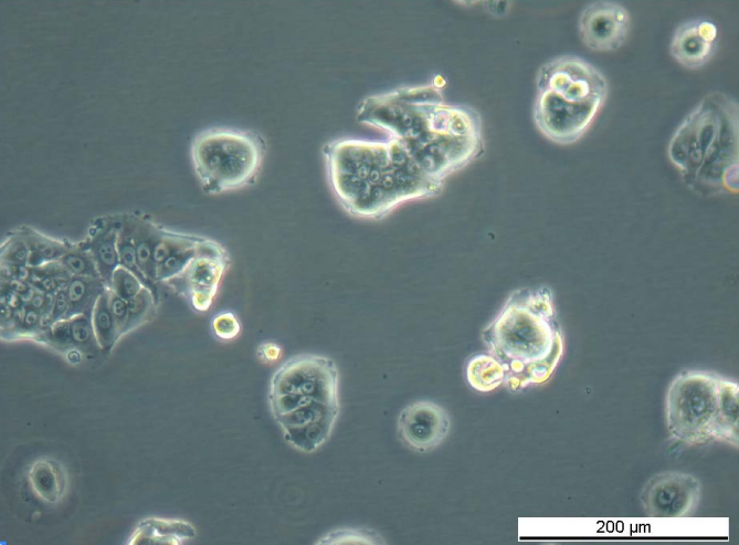 MCF7/TAMR-7 Cell Line. Early log phase. Image courtesy of the European Collection of Authenticated Cell Cultures (ECACC).