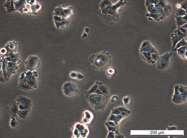 MCF7 TAMR-8 Cell Line. Early log phase. Image courtesy of the European Collection of Authenticated Cell Cultures (ECACC)