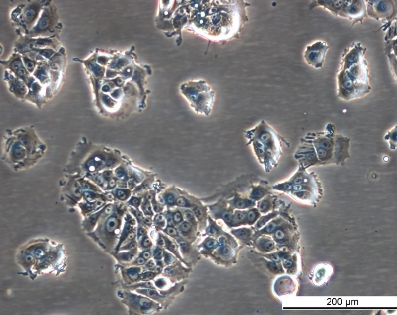 MCF7 TAMR-8 Cell Line. Mid log phase. Image courtesy of the European Collection of Authenticated Cell Cultures (ECACC), UK.