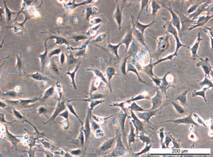 MEF OGG1 KO Cell Line. Early log phase. Image courtesy of the European Collection of Authenticated Cell Cultures (ECACC), UK.