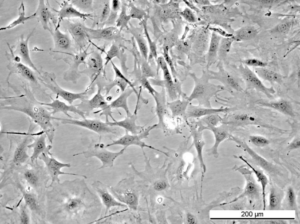 MEF RAF1 KO Cell Line. Early log phase. Image courtesy of the European Collection of Authenticated Cell Cultures (ECACC), UK.
