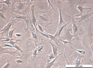 MEF Raf1 FF/FF KI Cell Line. Early log phase. Image courtesy of the European Collection of Authenticated Cell Cultures (ECACC), UK.