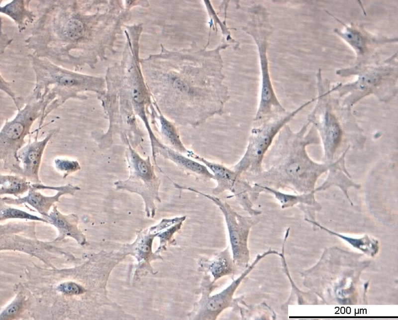 MEF Raf1 FF/FF KI Cell Line. Early log phase. Image courtesy of the European Collection of Authenticated Cell Cultures (ECACC), UK.