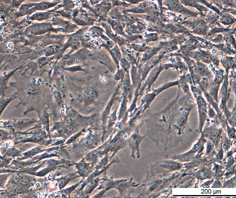 MEF Raf1 FF/FF KI Cell Line. Late log phase. Image courtesy of the European Collection of Authenticated Cell Cultures (ECACC), UK.