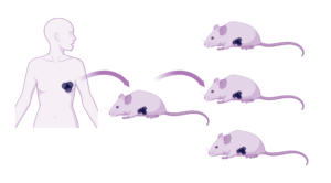 Image: Schematic illustrating the establishment of PDX models by grafting tumour tissues from a patient into immunodeficient mice, created with Biorender.