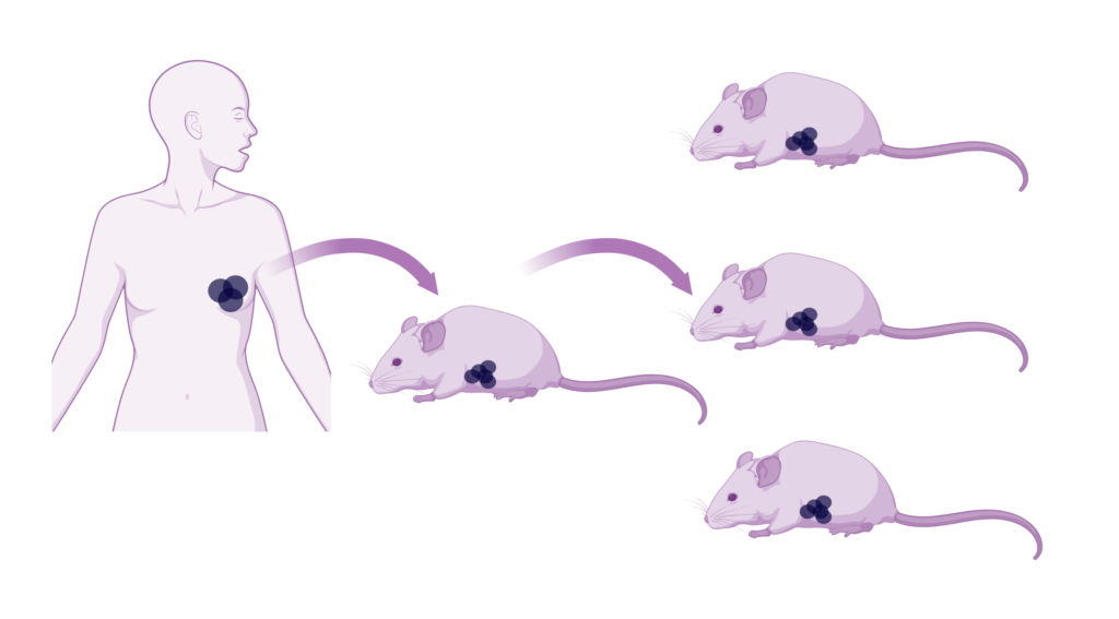 Image: Schematic illustrating the establishment of PDX models by grafting tumour tissues from a patient into immunodeficient mice, created with Biorender.