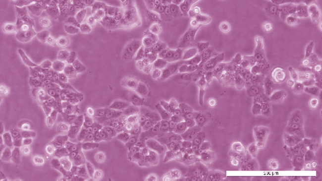 PEO1 Cell Line