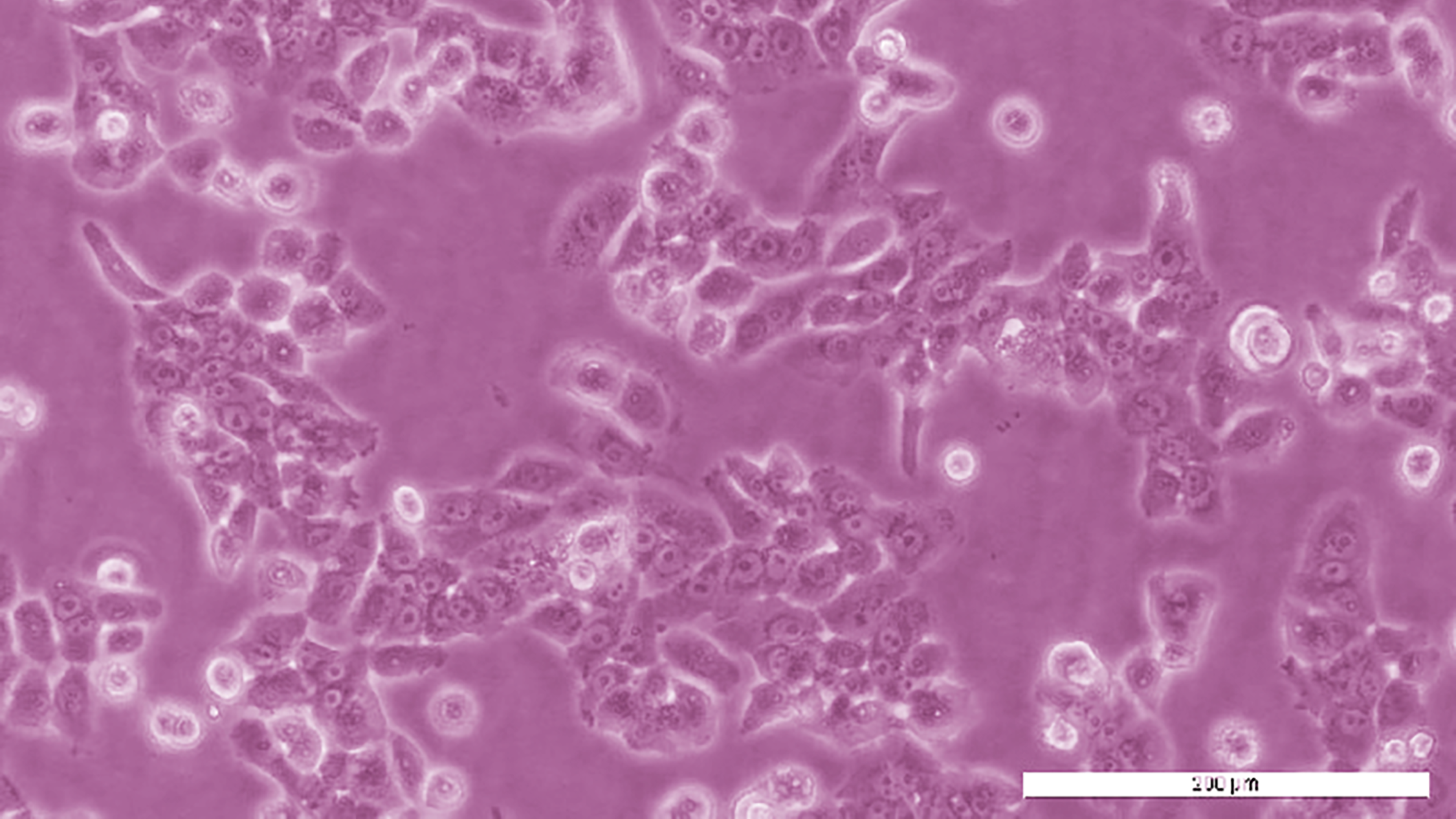 PEO1 Cell Line