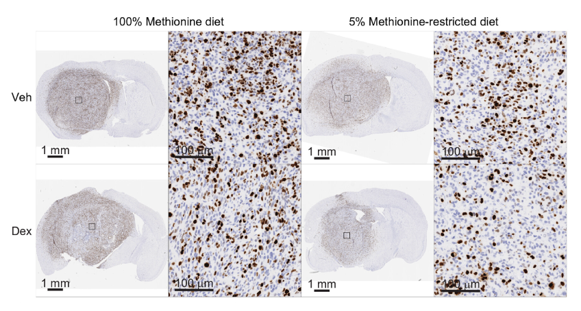 Figure 2. Combining Dex treatment with methionine restriction reduces glioblastoma cell proliferation in vivo. Ki67 immunohistochemistry (IHC) staining of brain tumour sections from orthotopic glioblastoma-bearing mice treated with Dex and/or methionine restricted diet. While methionine restriction alone had limited impact, combining methionine restriction with dexamethasone reduced the proportion of Ki67-positive tumour cells compared with either or treatment alone. Taken from Allega, M. F., et al., 2026.