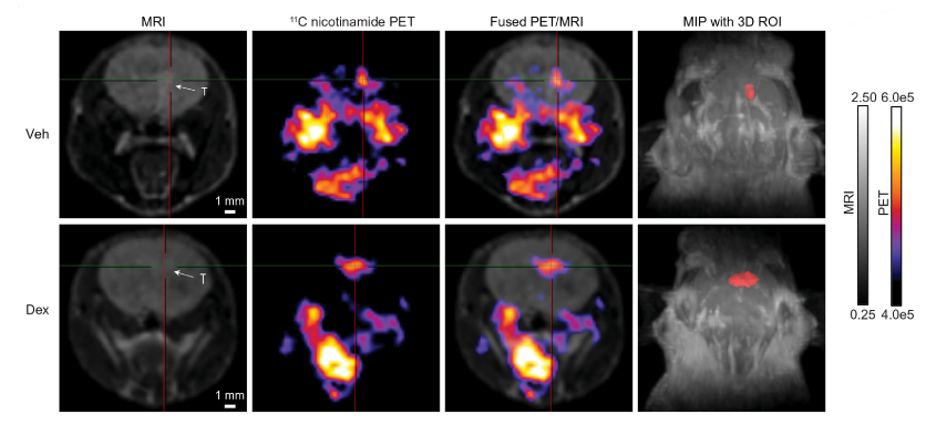 Figure 3. PET-MRI visualisation of nicotinamide metabolism in glioblastoma mouse models. Representative PET-MRI images of glioblastoma-bearing mice following administration of radiolabelled ¹¹C-nicotinamide. Tumour regions identified by MRI showed enhanced PET signal compared with surrounding normal brain tissue, demonstrating selective accumulation of nicotinamide-derived metabolites within glioblastoma. Taken from Allega, M. F., et al., 2026. 