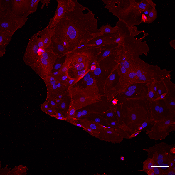 Plasmax with a human trophoblast stem cells