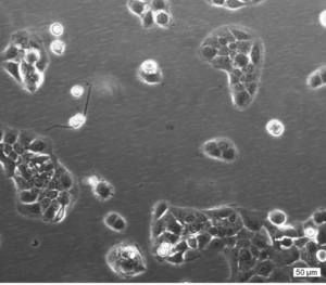 RT112/84 Cell Line. Image courtesy of the European Collection of Authenticated Cell Cultures (ECACC)