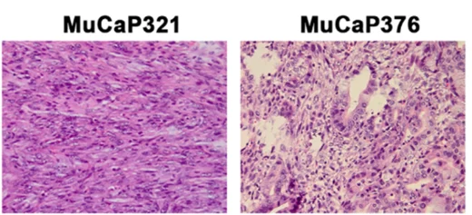 Image Reference: 2x PTEN -/- mouse prostate cancer cell lines (MuCap system). Histology staining of syngraft tumours (Van Duijn et al., 2018).