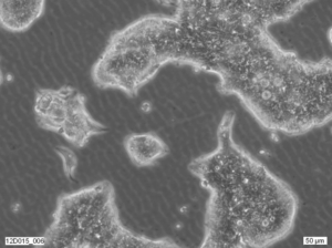 SW1222 cell line. Image courtesy of European Collection of Authenticated Cell Cultures (ECACC).