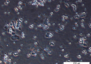 HCT 116 BRCA2 -/- 46 Cell Line. Early log phase. Image courtesy of the European Collection of Authenticated Cell Cultures (ECACC), UK.