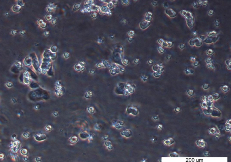 HCT 116 BRCA2 -/- 46 Cell Line. Early log phase. Image courtesy of the European Collection of Authenticated Cell Cultures (ECACC), UK.