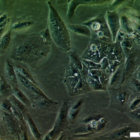 UM-RC-2 Cell Line. Image courtesy of the European Collection of Authenticated Cell Cultures (ECACC), UK.