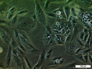 UM-RC-2 Cell Line. Image courtesy of the European Collection of Authenticated Cell Cultures (ECACC), UK.