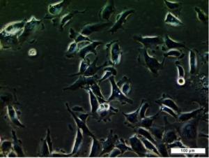 UM-RC-3 Cell Line. Image courtesy of the European Collection of Authenticated Cell Cultures (ECACC)