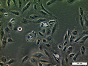 UM-RC-6 Cell Line. Image courtesy of the European Collection of Authenticated Cell Cultures (ECACC)
