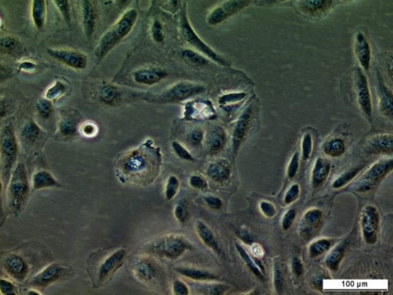 UM-RC-6 Cell Line. Image courtesy of the European Collection of Authenticated Cell Cultures (ECACC)