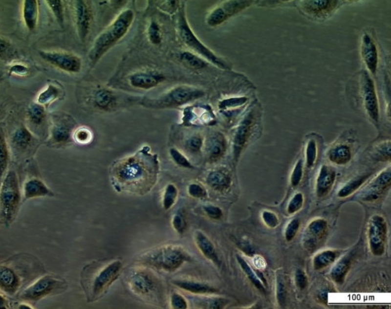 UM-RC-6 Cell Line. Image courtesy of the European Collection of Authenticated Cell Cultures (ECACC), UK.