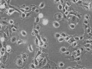 UM-UC-1 Cell Line. 24 hour post resuscitation. Image courtesy of the European Collection of Authenticated Cell Cultures (ECACC)