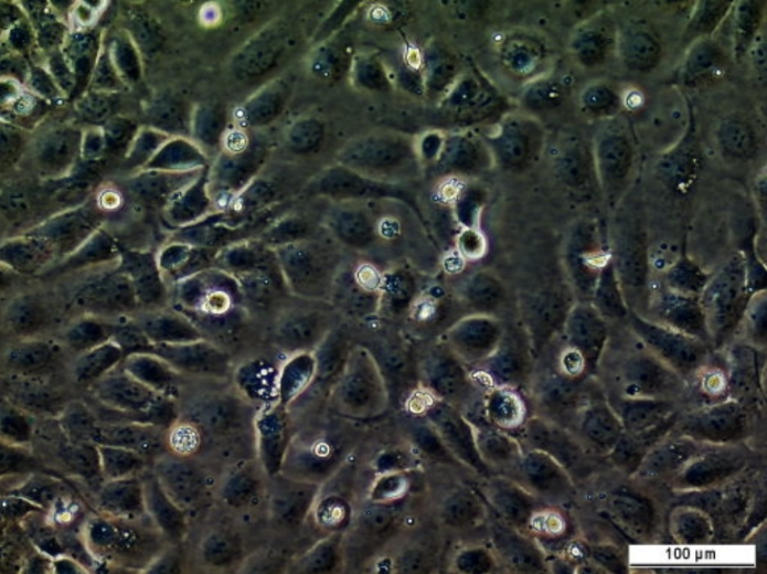 UM-UC-10 Cell Line. Image courtesy of the European Collection of Authenticated Cell Cultures (ECACC), UK.