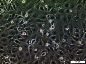 UM-UC-10 Cell Line. Image courtesy of the European Collection of Authenticated Cell Cultures (ECACC), UK.