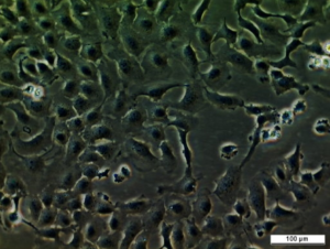 UM-UC-11 Cell Line. Image courtesy of the European Collection of Authenticated Cell Cultures (ECACC), UK.