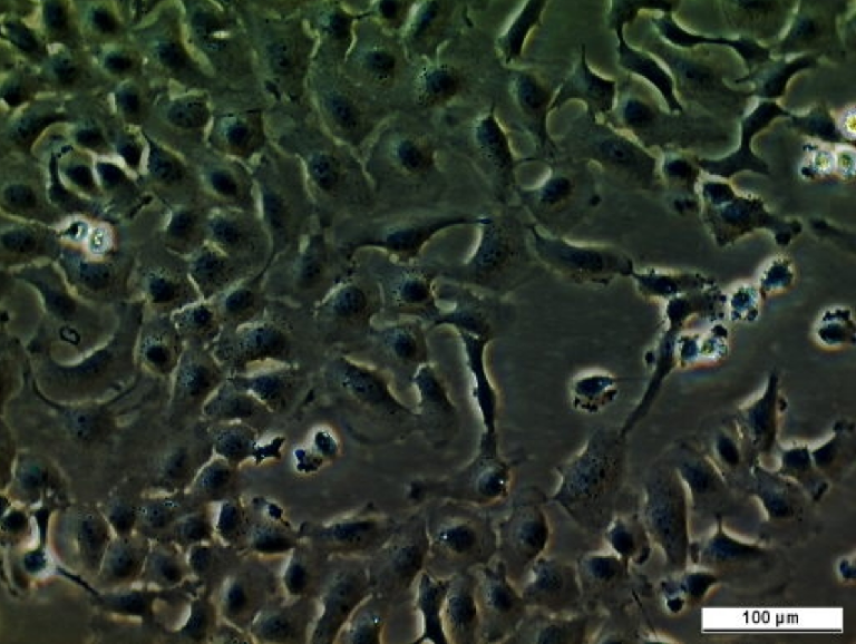 UM-UC-11 Cell Line. Image courtesy of the European Collection of Authenticated Cell Cultures (ECACC)