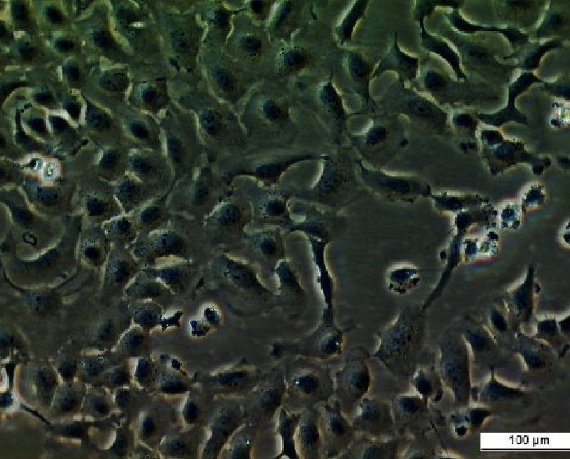 UM-UC-11 Cell Line. Image courtesy of the European Collection of Authenticated Cell Cultures (ECACC), UK.