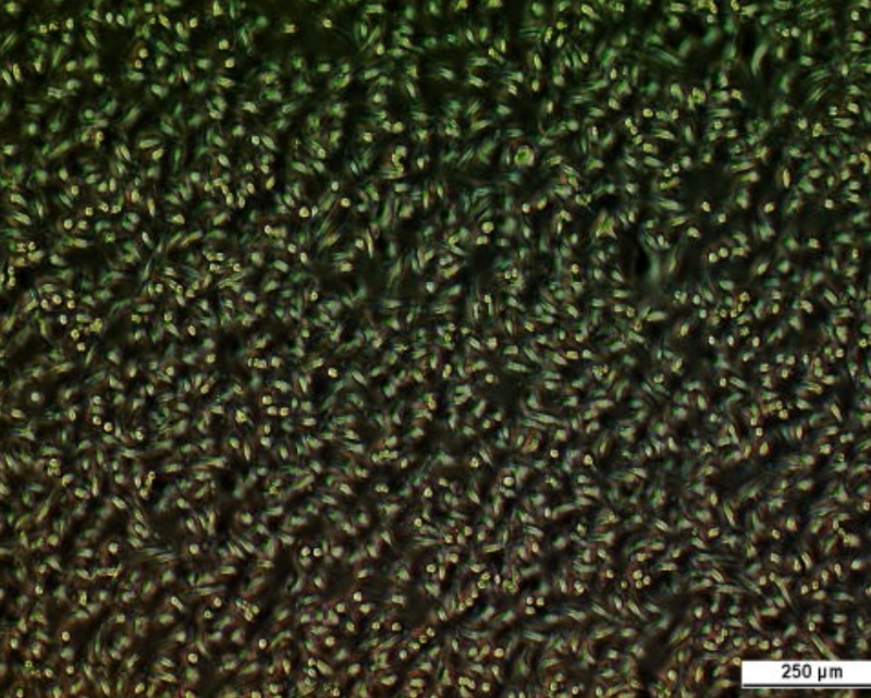 UM-UC-13 Cell Line. Image courtesy of the European Collection of Authenticated Cell Cultures (ECACC), UK.