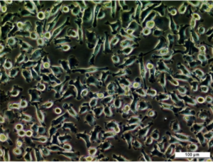 UM-UC-13 Cell Line. Image courtesy of the European Collection of Authenticated Cell Cultures (ECACC), UK.