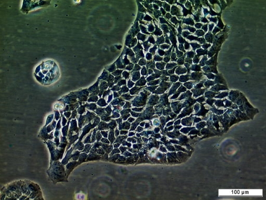 UM-UC-14 Cell Line. Image courtesy of the European Collection of Authenticated Cell Cultures (ECACC), UK.