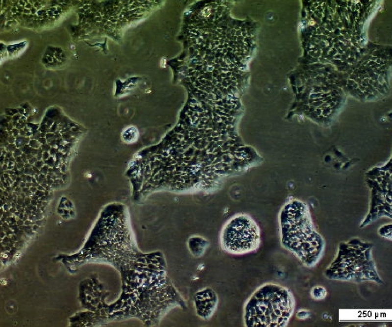 UM-UC-14 Cell Line. Image courtesy of the European Collection of Authenticated Cell Cultures (ECACC), UK.