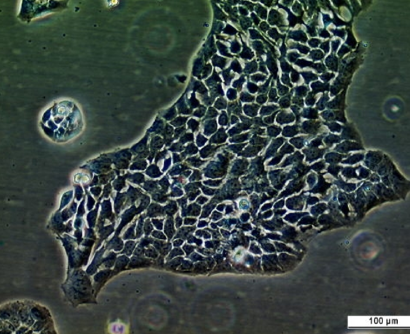 UM-UC-14 Cell Line. Image courtesy of the European Collection of Authenticated Cell Cultures (ECACC), UK.