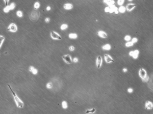 UM-UC-3 Cell Line. Image courtesy of the European Collection of Authenticated Cell Cultures (ECACC).