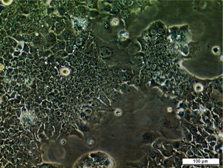 UM-UC-4 Cell Line. Image courtesy of the European Collection of Authenticated Cell Cultures (ECACC)