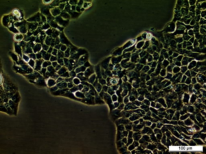 UM-UC-5 Cell Line. Image courtesy of the European Collection of Authenticated Cell Cultures (ECACC), UK.