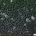 UM-UC-6 Cell Line. Image courtesy of the European Collection of Authenticated Cell Cultures (ECACC).