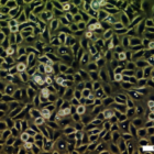 UM-UC-6 Cell Line 2. Image courtesy of the European Collection of Authenticated Cell Cultures (ECACC).