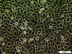 UM-UC-6 Cell Line 2. Image courtesy of the European Collection of Authenticated Cell Cultures (ECACC).