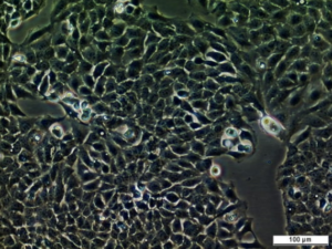 UM-UC-6 Cell Line. Image courtesy of the European Collection of Authenticated Cell Cultures (ECACC).