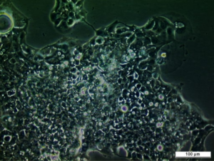 UM-UC-7 Cell Line. Image courtesy of the European Collection of Authenticated Cell Cultures (ECACC), UK.